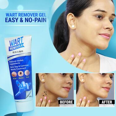 Wart Remover Gel